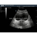 Sura ya Ultrasound Scanner Digital Ultrasound Machine Price